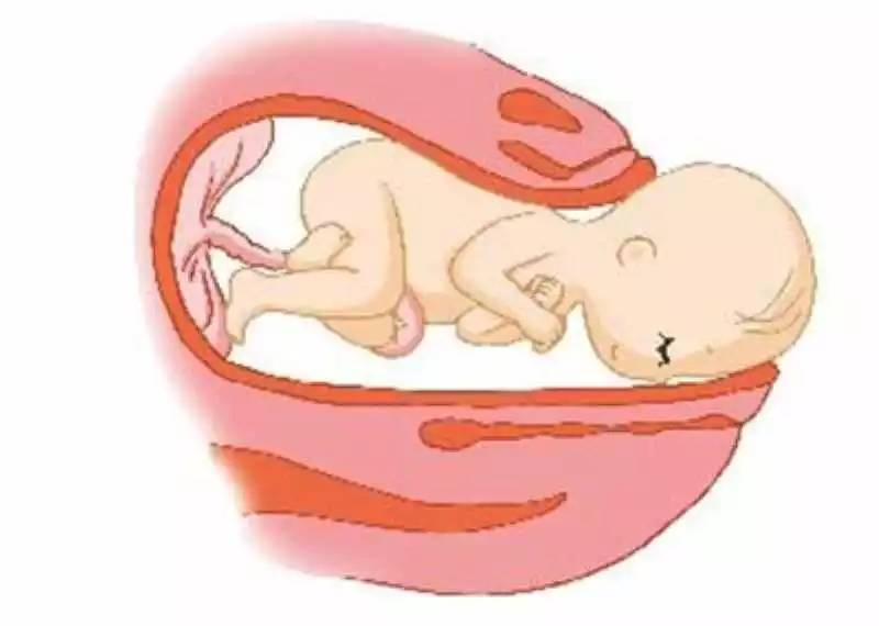 「科普」剖腹产的女明星那么多,为啥瘦小的“教主夫人”(杨颖)却能顺产?