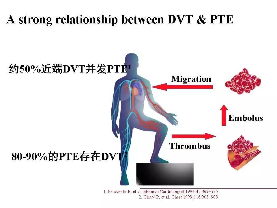解读︱静脉血栓栓塞症预防和治疗指南