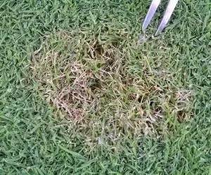 攻克黄斑病变,攻克白化病