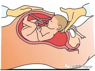 「分娩前后」想要顺产?看完这个就放心了!