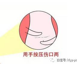 剖宫产后哪些症状是正常的,自然分娩和剖宫产术后观察哪些