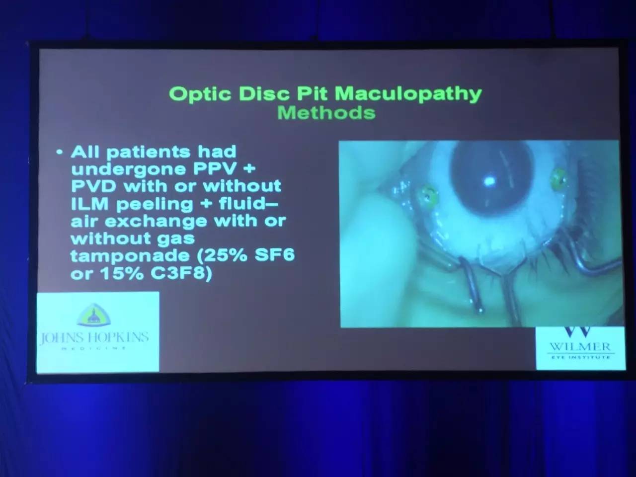 视网膜黄斑缺损能治好吗,视网膜黄斑缺损