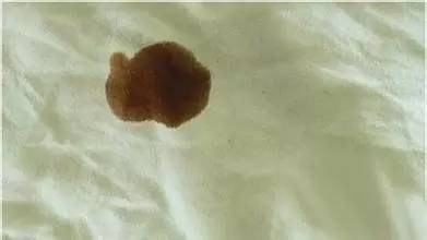 新衣服洗完后有油渍是怎么回事,衣服上弄了油渍洗不掉要怎么处理