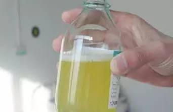 「健康」尿常规报告上这几个指标,告诉你肾好不好!