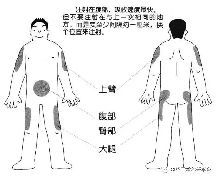 胰岛素最怕什么食物,胰岛素最怕的是吃撑