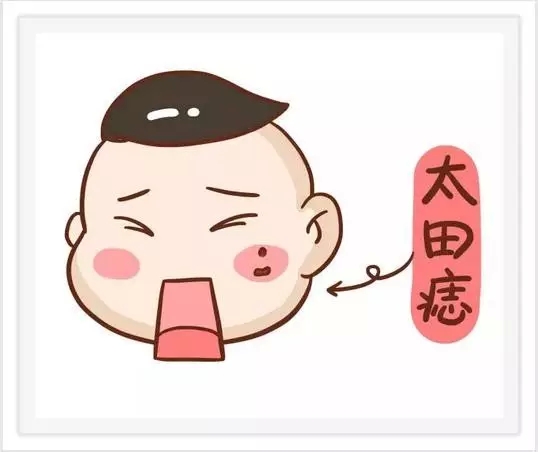 胎记好坏图片大全,孩子有胎记一般都是怎么造成的