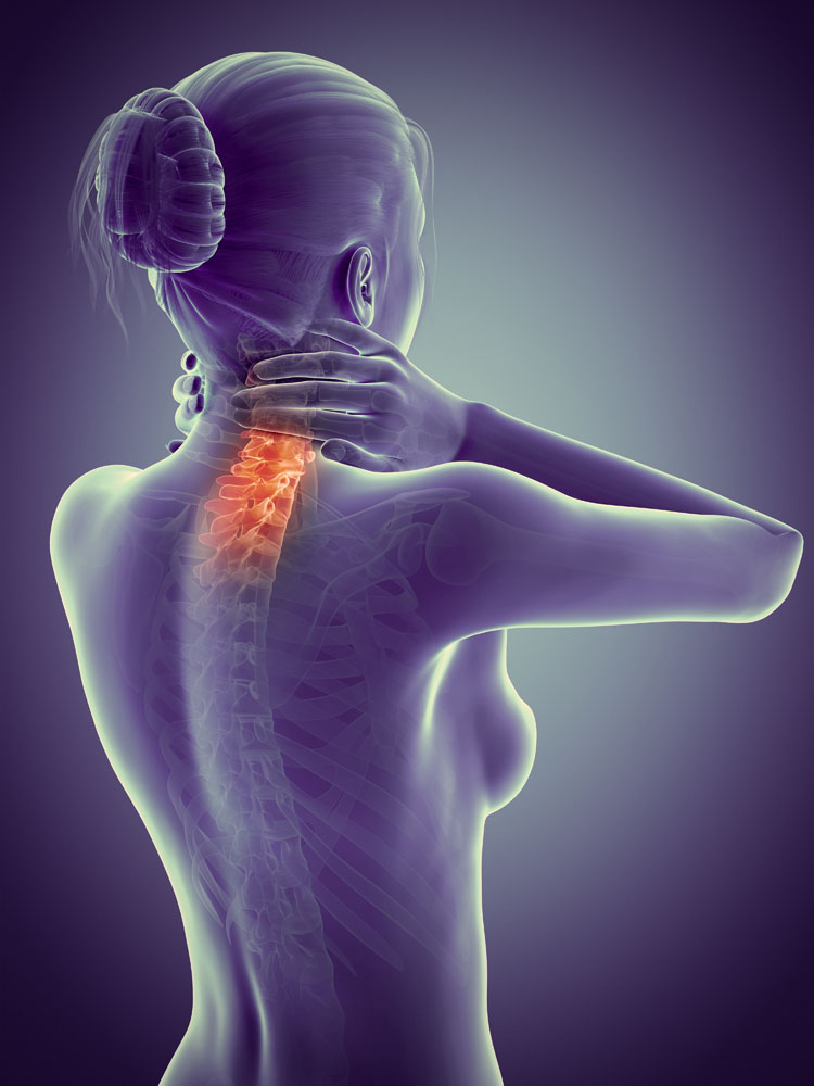 颈椎曲度变直是什么意思严重吗,颈椎生理曲度变直什么原因引起的