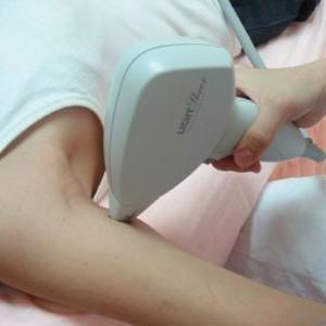 来介绍时下普遍应用的脱毛方法,脱毛技术的发展过程