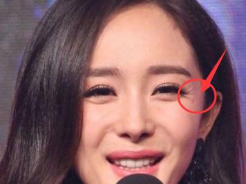 爱笑的女孩皱纹多怎么回复,爱笑的女孩细纹总是特别多