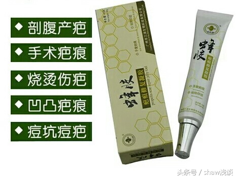 漫漫去疤路，对你有用的去疤好用物合集