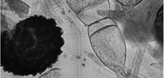 酸奶酵母菌的做法,制作酸奶要真菌还是细菌