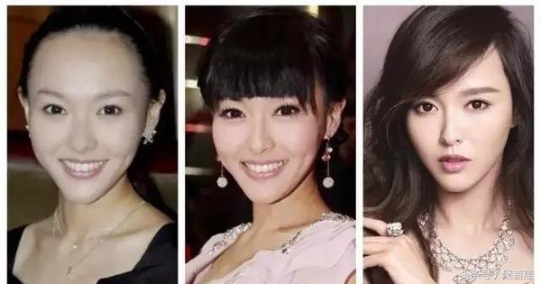 word天！听说杨幂以后会变秃头？