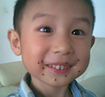 宝宝身上黑点跟痣一样,宝宝身上像红痣的点