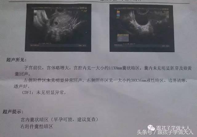 准妈去医院验孕用的是哪种方法?这些方法你可能听都没听过!