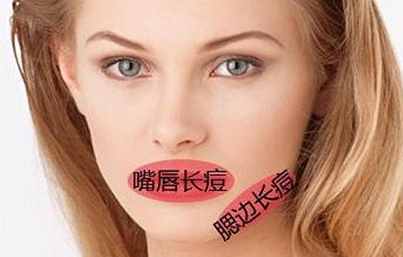 8张图让你秒懂长痘的原因,原来这才是长痘的真实原因