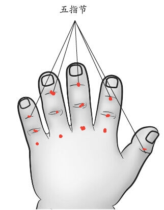 吴老师推荐：上午孩子从床上摔下来，下午就发烧