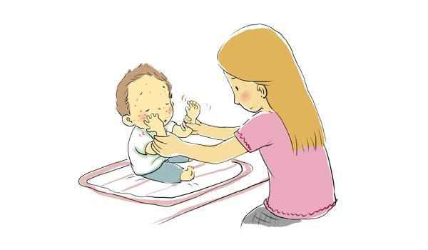 宝宝湿疹的原因及解决方法,宝宝得湿疹了怎么办及注意什么