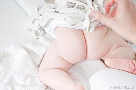 宝宝的屁屁总是红红的怎么办,宝宝红屁屁起疹子怎么快速消除
