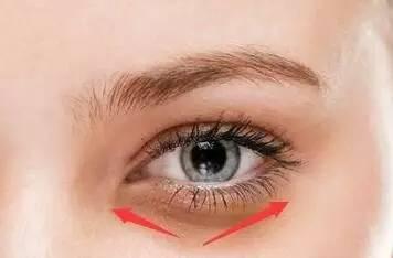 消除黑眼圈和眼袋的最有效的方法,最严重的黑眼圈
