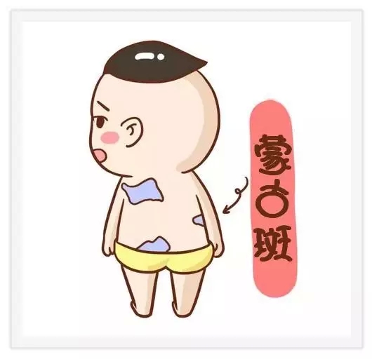 胎记好坏图片大全,孩子有胎记一般都是怎么造成的