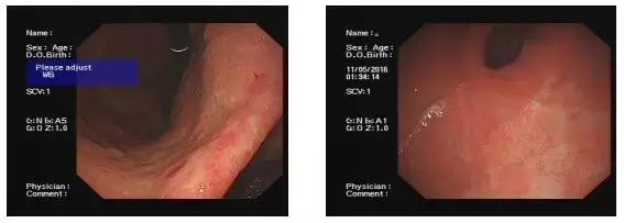 舌苔辨证图谱望舌识病,揭秘舌苔图谱轻松自诊