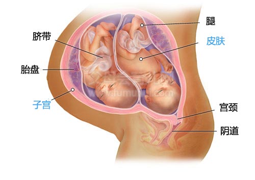双胞胎一大一小怎么治疗,双胞胎一大一小严重吗