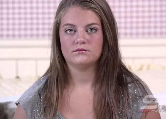 关于法令纹的种种误解,法令纹出现不要怕选对方法很重要