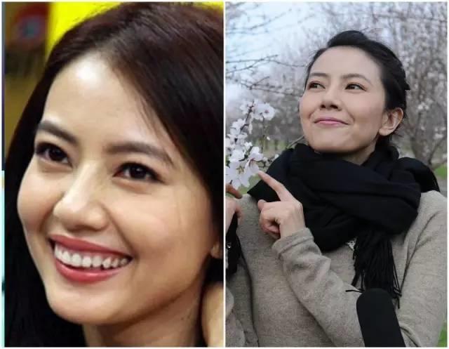 关于法令纹的种种误解,法令纹出现不要怕选对方法很重要