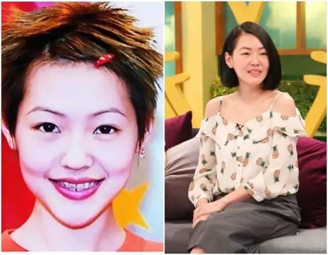 关于法令纹的种种误解,法令纹出现不要怕选对方法很重要