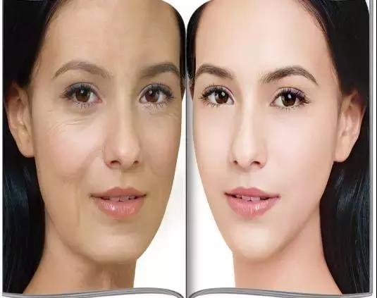 扁平脸如何抗老还年轻,皮肤松弛吃什么能紧致抗老