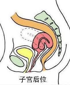 生完孩子什么时候才不痛经,生完孩子就不痛经了现在又痛了