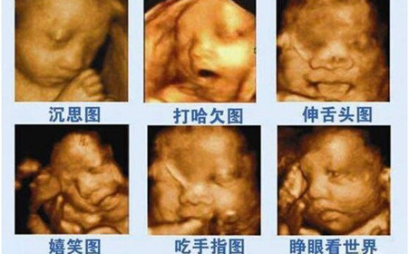 孕检彩超部分显示不清晰,怎么看四维彩超的蓝色和粉色