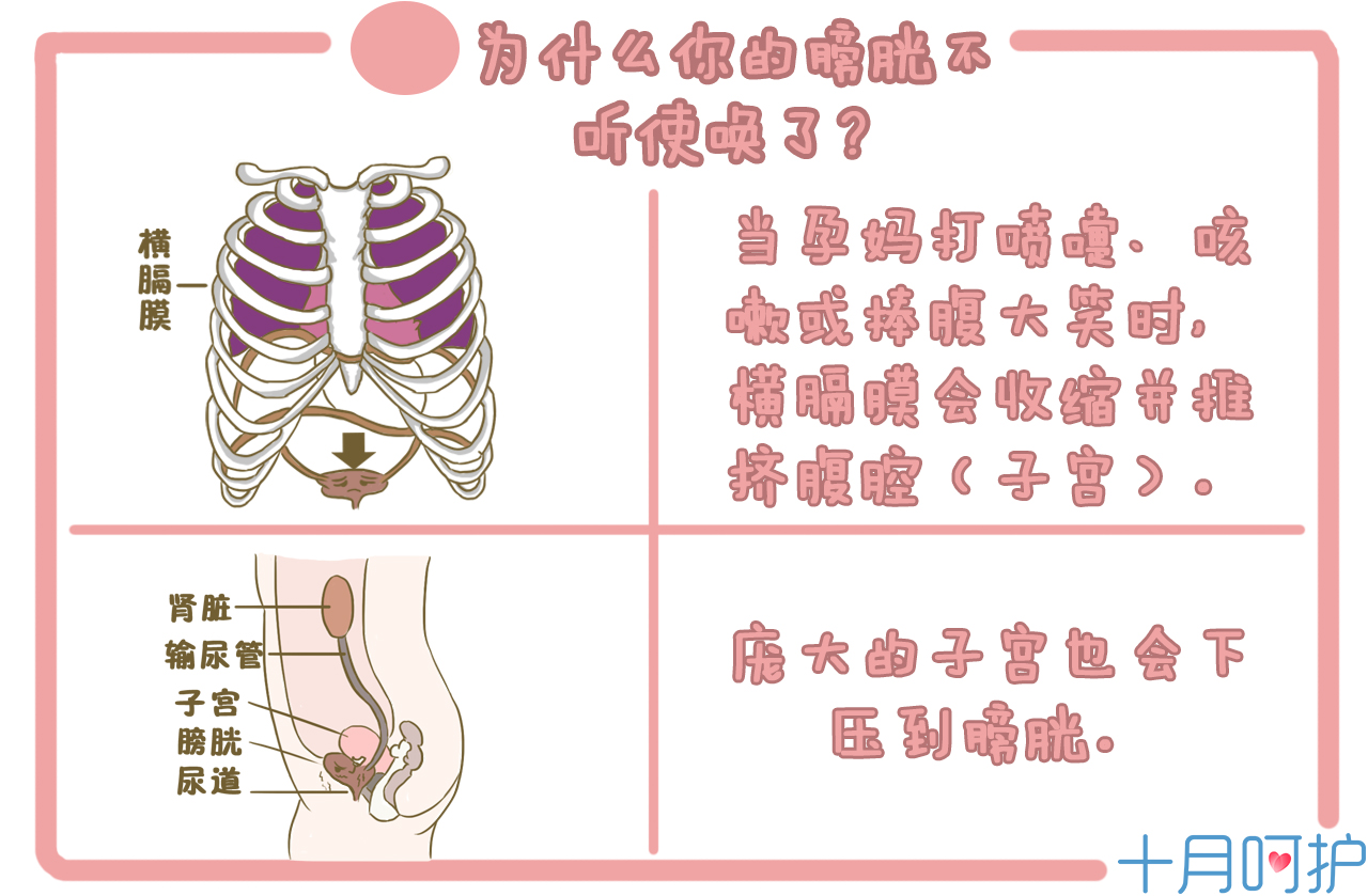 孕期尿裤子怎么处理,孕妇出现尿裤子如何控制与改善