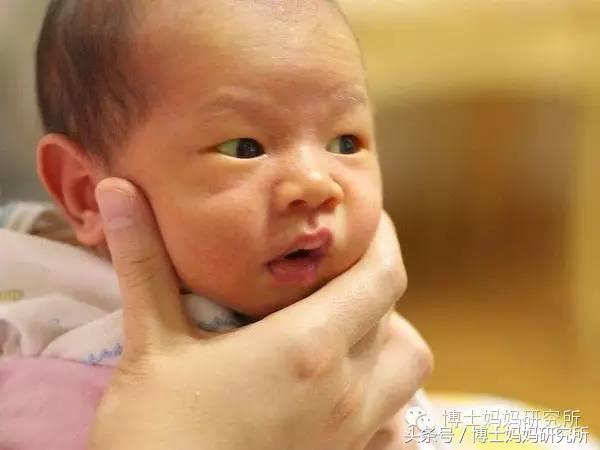 新生儿黄疸的有关护理诊断,新生儿黄疸不用慌消退黄疸有妙招