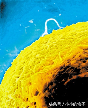 先兆流产为什么都是用黄体酮,先兆流产用黄体酮可以吗