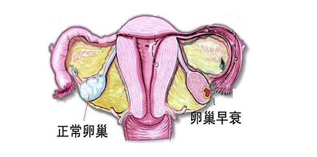 卵巢保养违法吗,卵巢保养真的有用吗