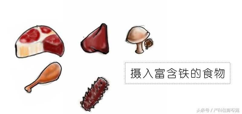 怀孕了有点贫血怎么办,怀孕缺铁性贫血