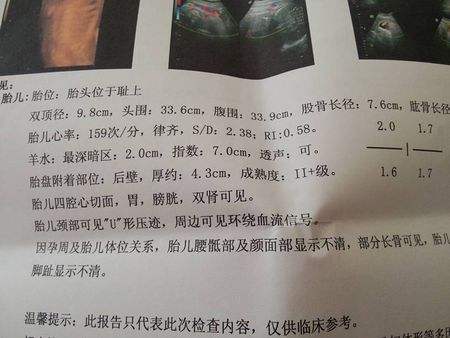 孕36周羊水少是什么原因造成的呢,24周羊水少说明胎儿一定有问题吗