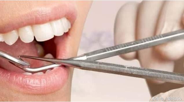怀孕牙痛怎么办快速解决,晚上睡觉牙痛快速解决