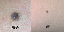 宝宝身上黑点跟痣一样,宝宝身上像红痣的点