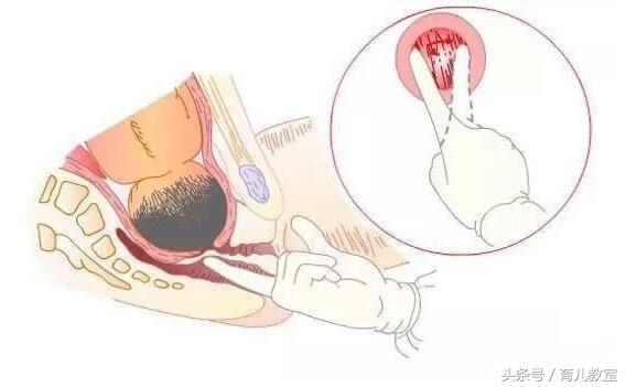 自然分娩的三个产程,打算顺产的准妈妈千万要记得