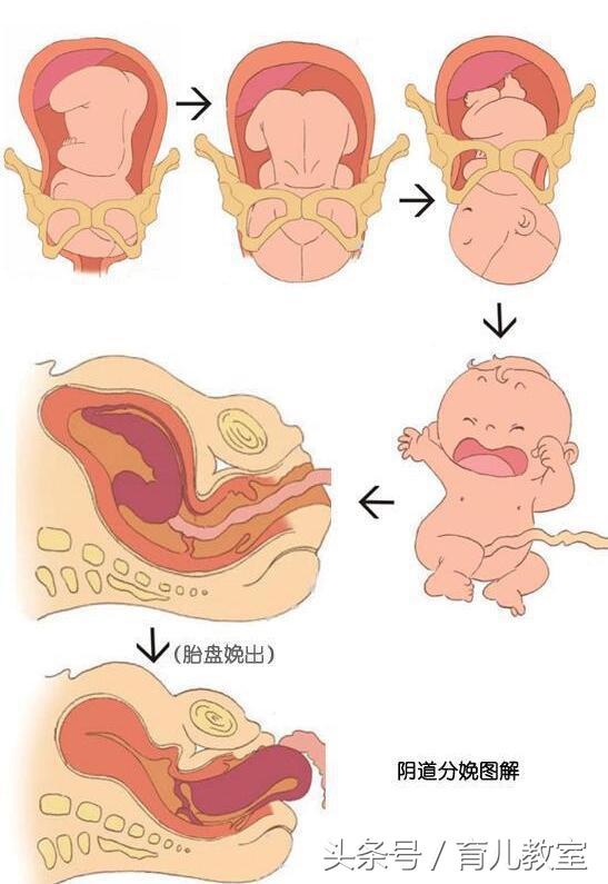 自然分娩的三个产程,打算顺产的准妈妈千万要记得