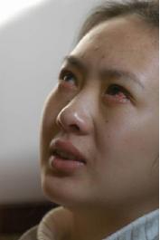 童瑶被张默打的图片,童瑶被张默打怎么处理的