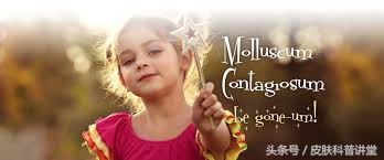 小孩传染性软疣冷冻后变成了水泡,儿童常见皮肤病疣