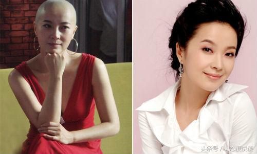女星光头形象对比,女星光头真实照片