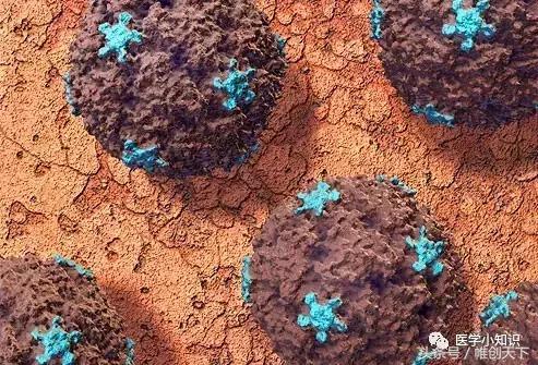 鼻窦炎引起头痛怎么治疗,鼻窦炎的症状及食疗视频播放