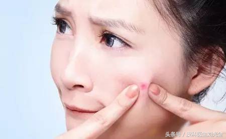治疗痤疮最新研究进展,治疗青春痘最新视频