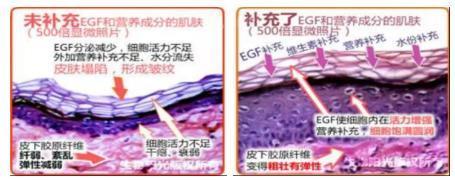 黄金微针祛除颈纹,去除颈纹的微针视频