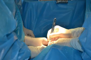 angelababy是顺产吗,angelababy是剖腹产还是顺产