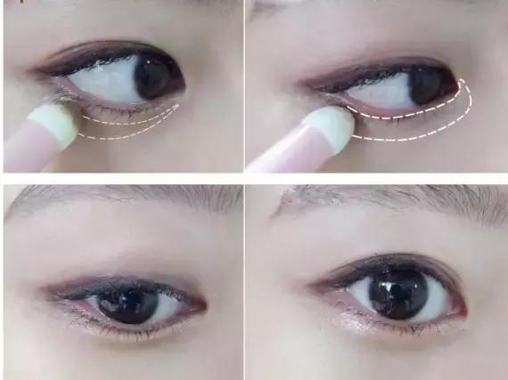 卧蚕眼袋黑眼圈傻傻分不清楚,卧蚕与眼袋别傻傻分不清楚